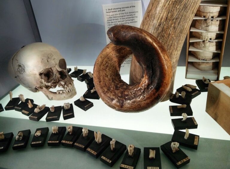 the hunterian museum in london